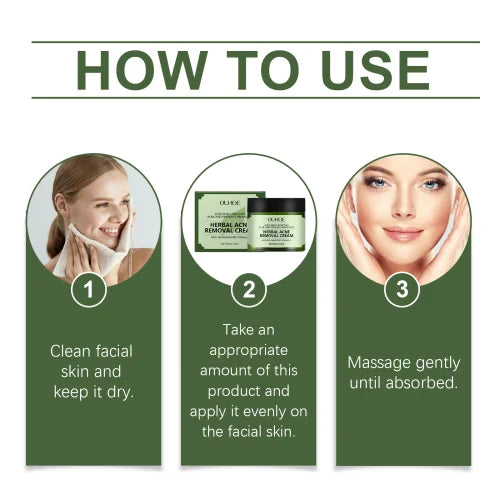 Herbal Acne Cream