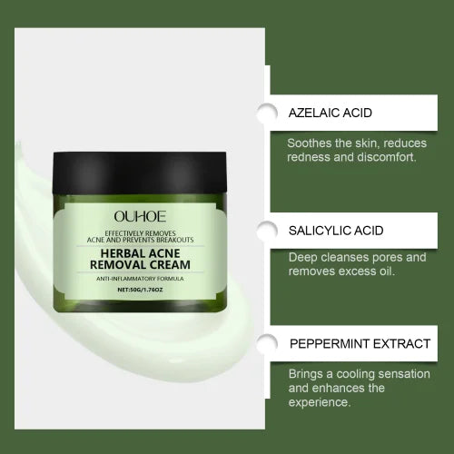Herbal Acne Cream