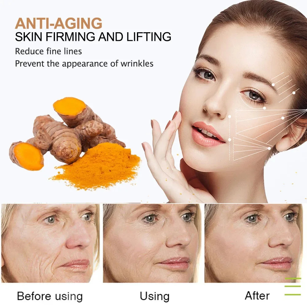 Turmeric lemon Skin Care products Acne Dark Spot Remover…