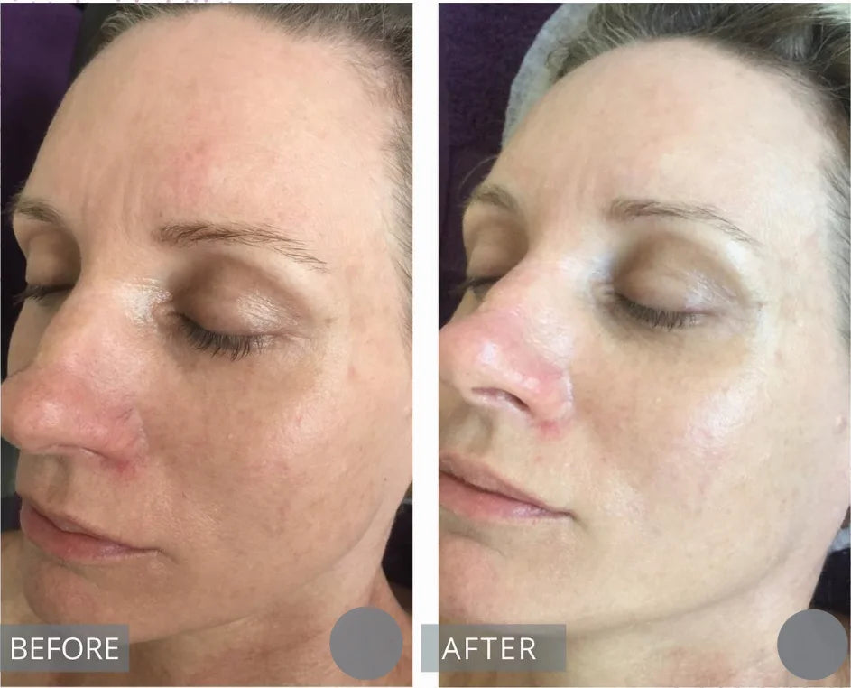 Centella Serum Nourish Improvement