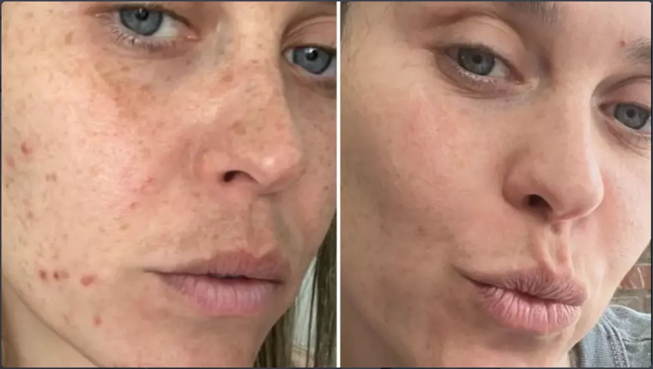 Centella Serum Nourish Improvement