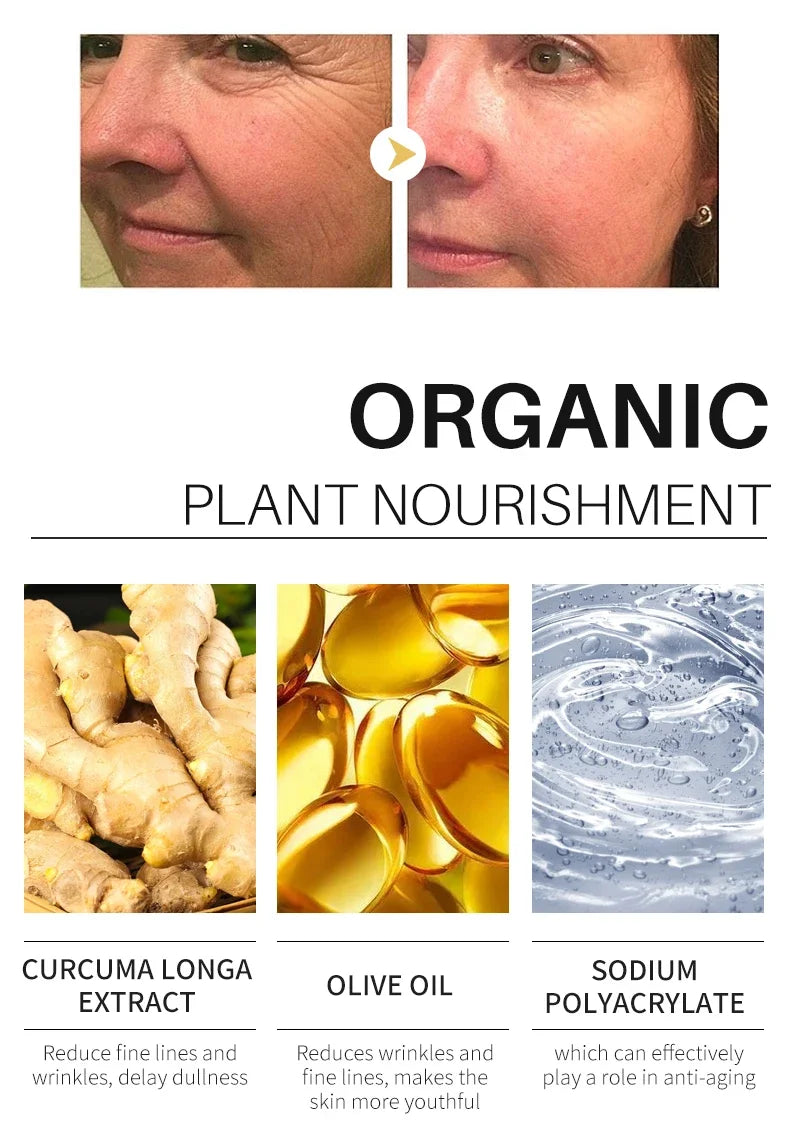 Turmeric lemon Skin Care products Acne Dark Spot Remover…
