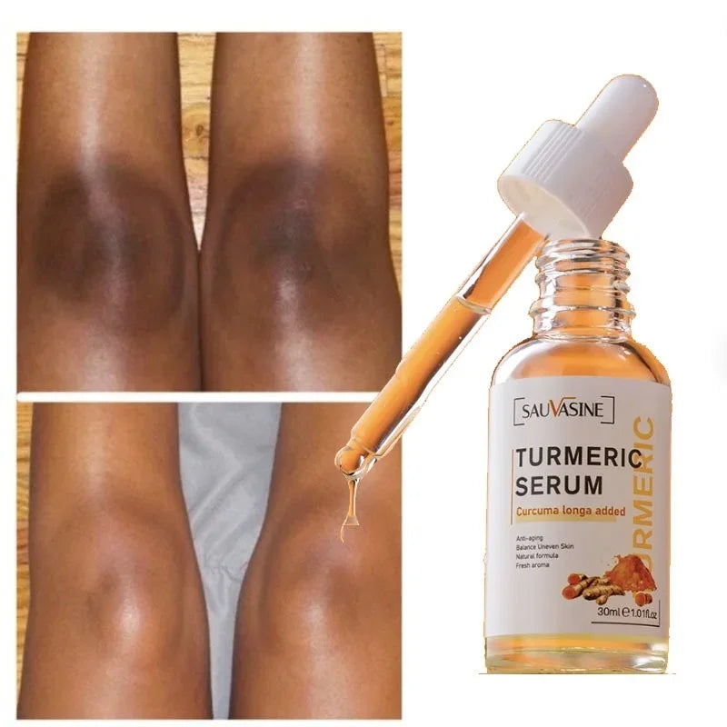 Turmeric lemon Skin Care products Acne Dark Spot Remover…