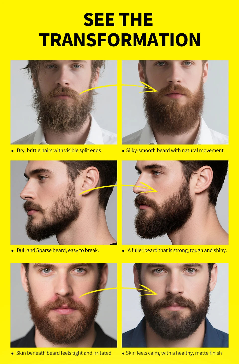 SEVICH Natural Beard Growth Oil for Men