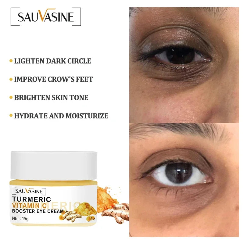 Turmeric lemon Skin Care products Acne Dark Spot Remover…