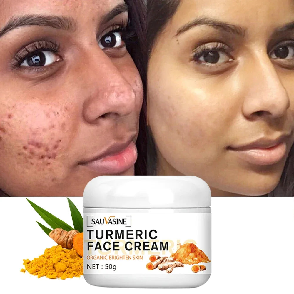 Turmeric lemon Skin Care products Acne Dark Spot Remover…