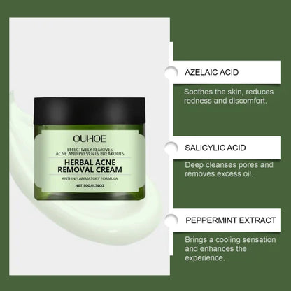 Herbal Acne Cream