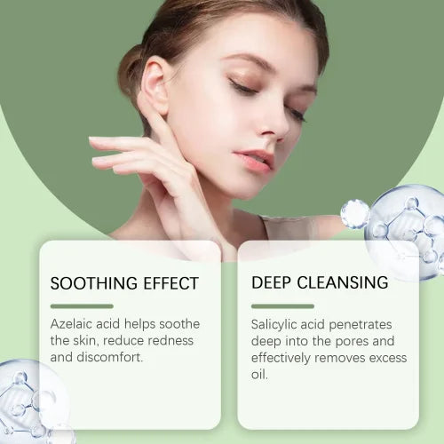 Herbal Acne Cream