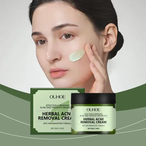 Herbal Acne Cream